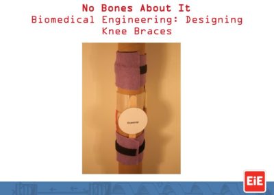 Engineering is Elementary (EIE) Kit: Knee Braces